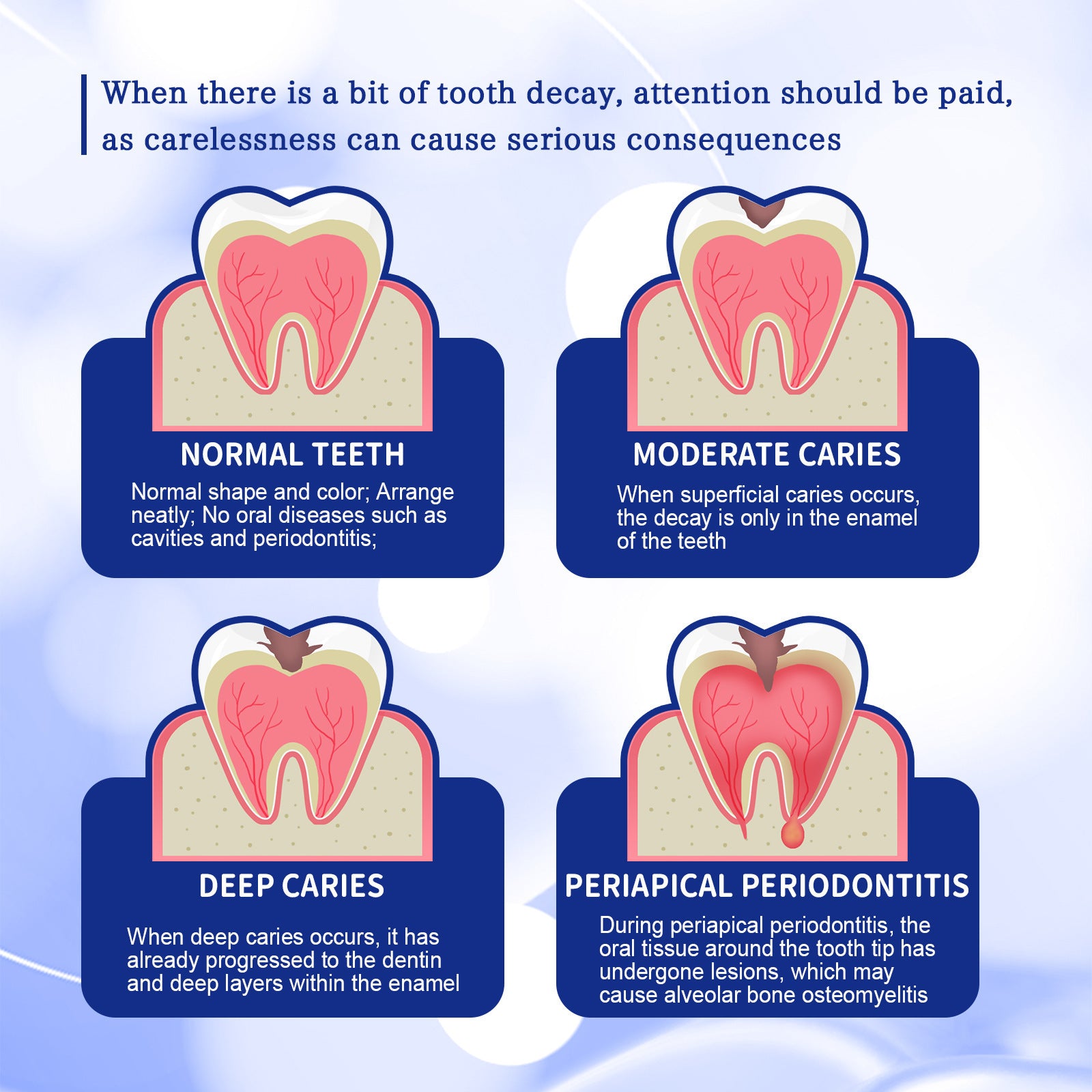 Anticavity Toothpaste Oral Cleaning Yellow Tooth Decay Tooth Care Gum Fixation Tooth Care Breath Anticavity Toothpaste Oral Cleaning Yellow Tooth Decay Tooth Care Gum Fixation Tooth Care Breath