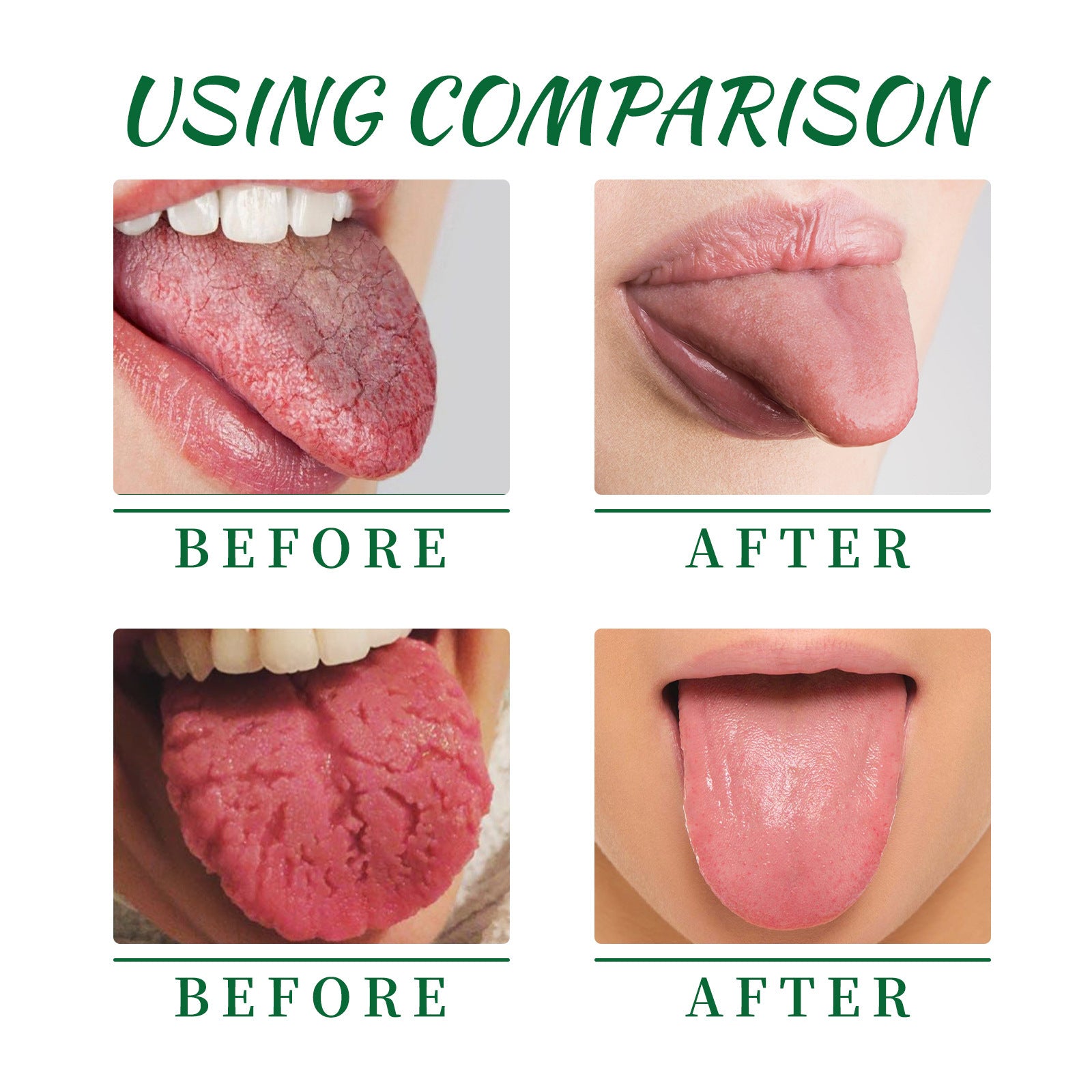 EELHOE Tongue Repair Spray Repair White Tongue Relief Dry Swollen Tongue Oral Care Spray EELHOE Tongue Repair Spray Repair White Tongue Relief Dry Swollen Tongue Oral Care Spray