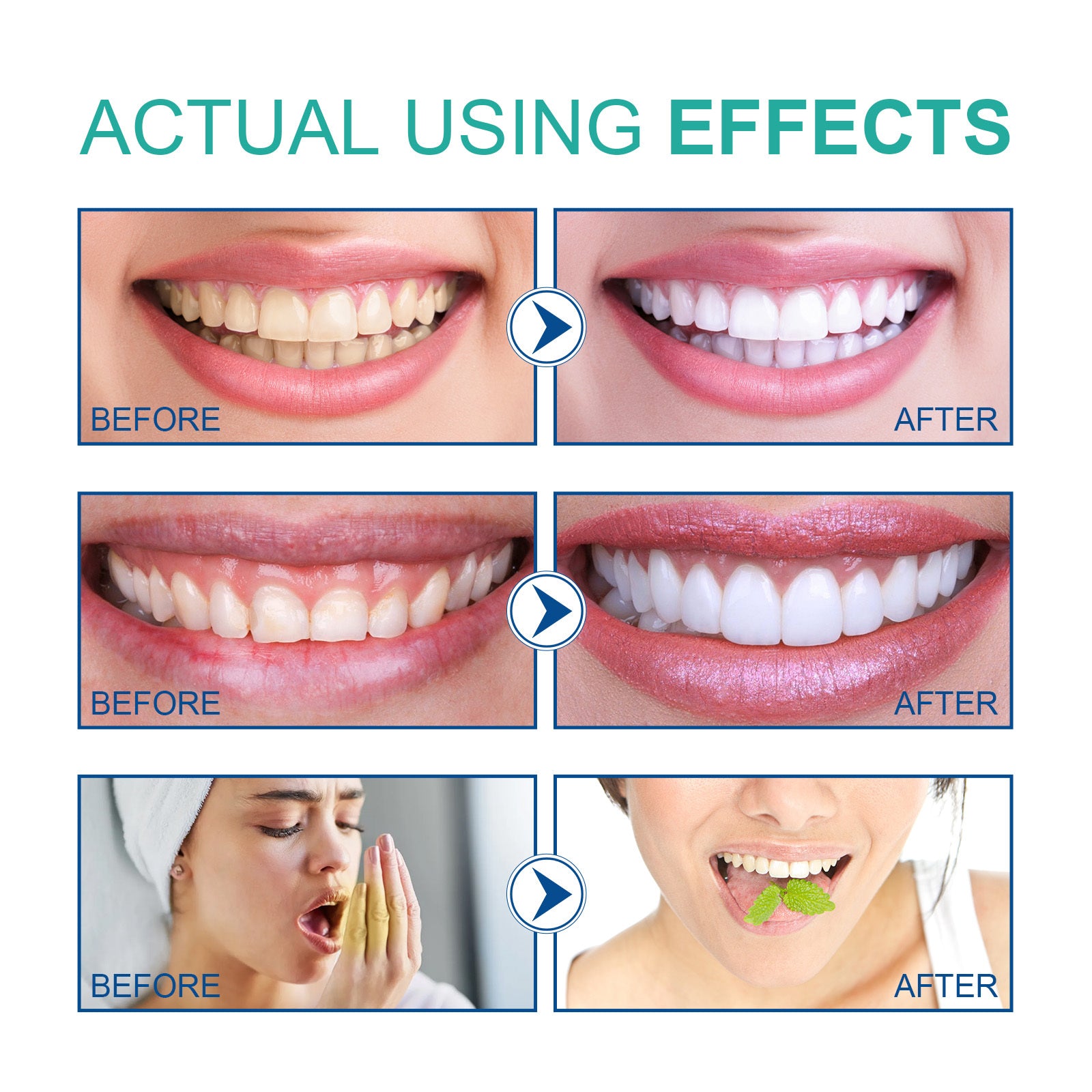 Coconut Oil Mouthwash Removes Odor, Removes Tooth Stains, Freshens Breath, Cares For Teeth, Oral Care Tooth Cleanser Coconut Oil Mouthwash Removes Odor, Removes Tooth Stains, Freshens Breath, Cares For Teeth, Oral Care Tooth Cleanser