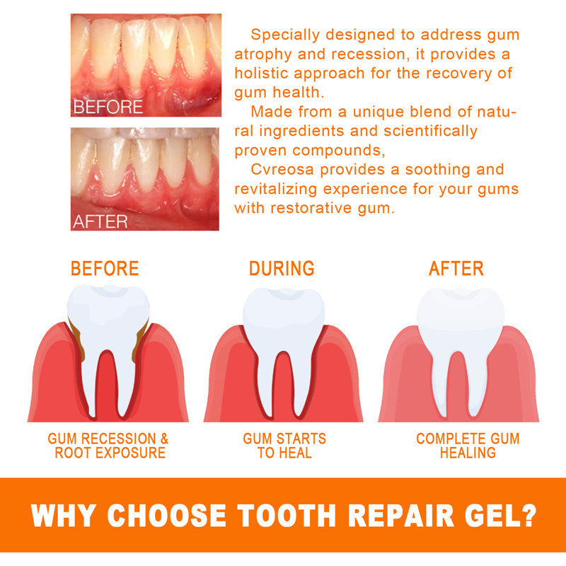Teeth Repair Deep Cleaning Teeth Yellow Teeth Stain Tartar Care Gum Oral Care Teeth Repair Deep Cleaning Teeth Yellow Teeth Stain Tartar Care Gum Oral Care