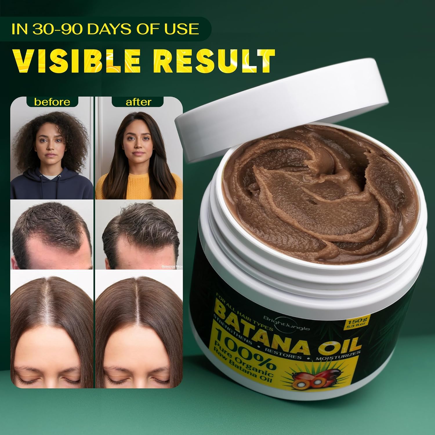 Batana Oil for hair Growth - Dr. Sebi-inspired 100% Pure & Organic Raw Batana Oil Prevent Hair Loss, Promotes Hair thickness for Men & Women - 5.29 oz Batana Oil for hair Growth - Dr. Sebi-inspired 100% Pure & Organic Raw Batana Oil Prevent Hair Loss, Promotes Hair thickness for Men & Women - 5.29 oz
