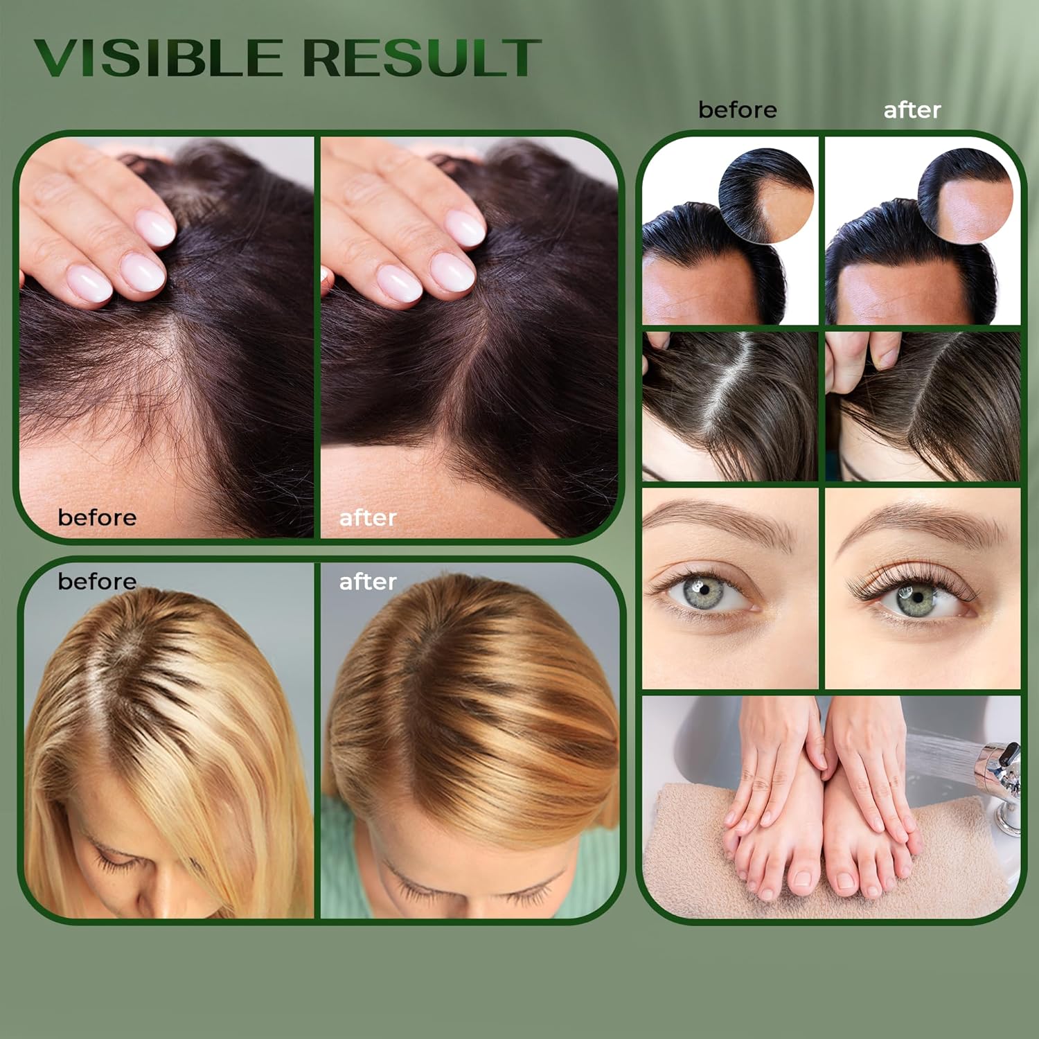 Premium Batana Oil for Hair Care - 100% Pure Organic - 120ml / 4 Fl Oz | Premium Aceite de Batana with Pleasant Aroma | Easy Application Premium Batana Oil for Hair Care - 100% Pure Organic - 120ml / 4 Fl Oz | Premium Aceite de Batana with Pleasant Aroma | Easy Application