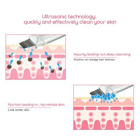 Ultrasonic Skin Scrubber Face Cleanser Blackhead Acne Removal Facial Spa Vibration Massager Ultrasound Peeling Clean Machine 394 Ultrasonic Skin Scrubber Face Cleanser Blackhead Acne Removal Facial Spa Vibration Massager Ultrasound Peeling Clean Machine 394
