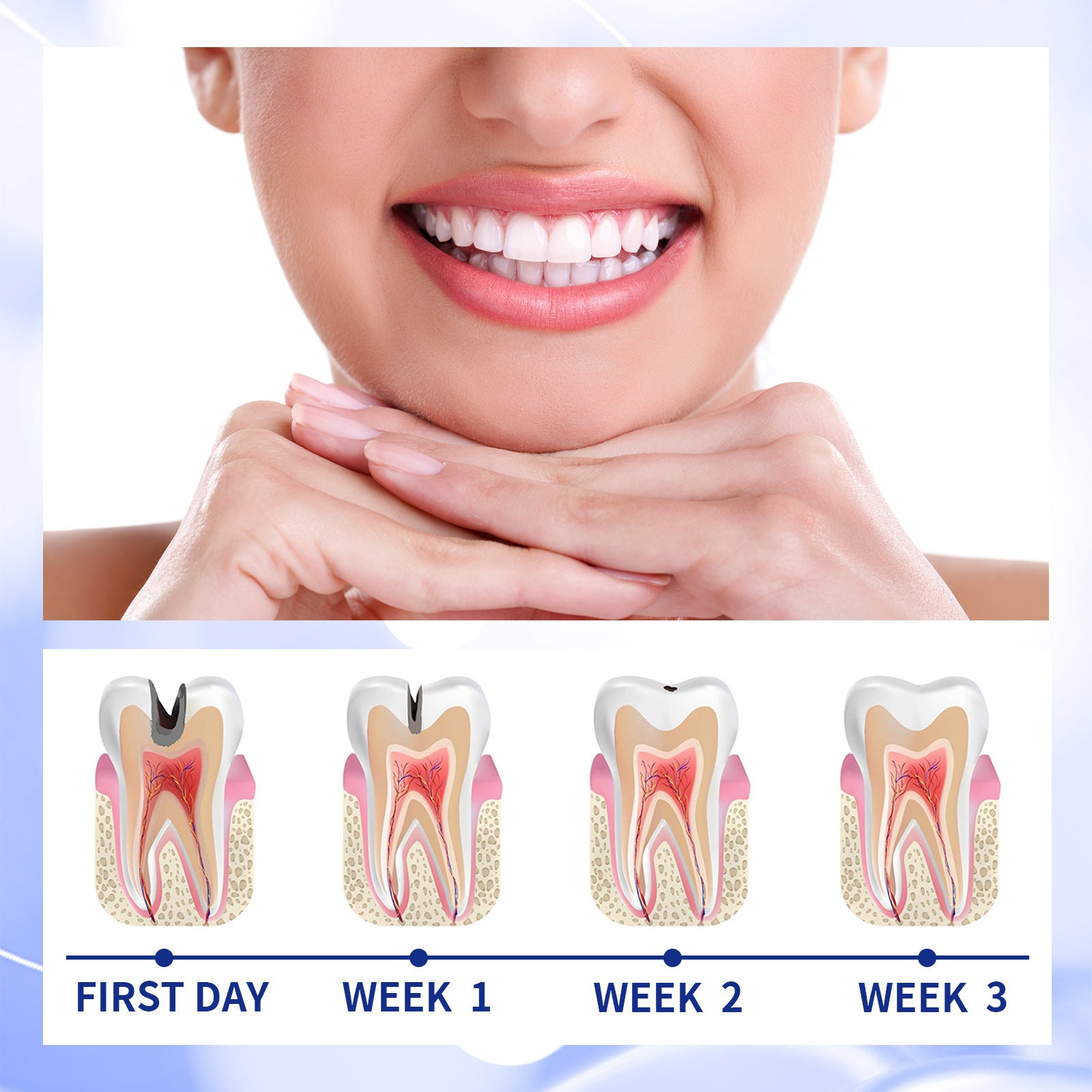 Anticavity Toothpaste Oral Cleaning Yellow Tooth Decay Tooth Care Gum Fixation Tooth Care Breath Anticavity Toothpaste Oral Cleaning Yellow Tooth Decay Tooth Care Gum Fixation Tooth Care Breath
