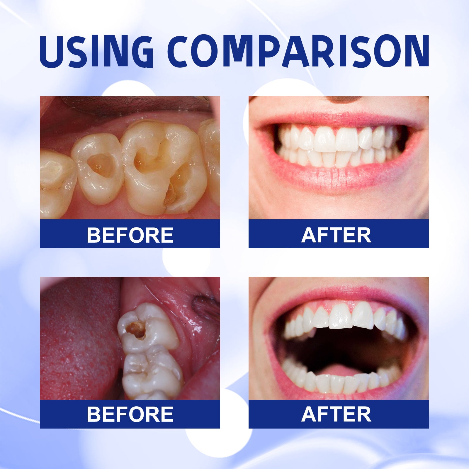 Anticavity Toothpaste Oral Cleaning Yellow Tooth Decay Tooth Care Gum Fixation Tooth Care Breath Anticavity Toothpaste Oral Cleaning Yellow Tooth Decay Tooth Care Gum Fixation Tooth Care Breath