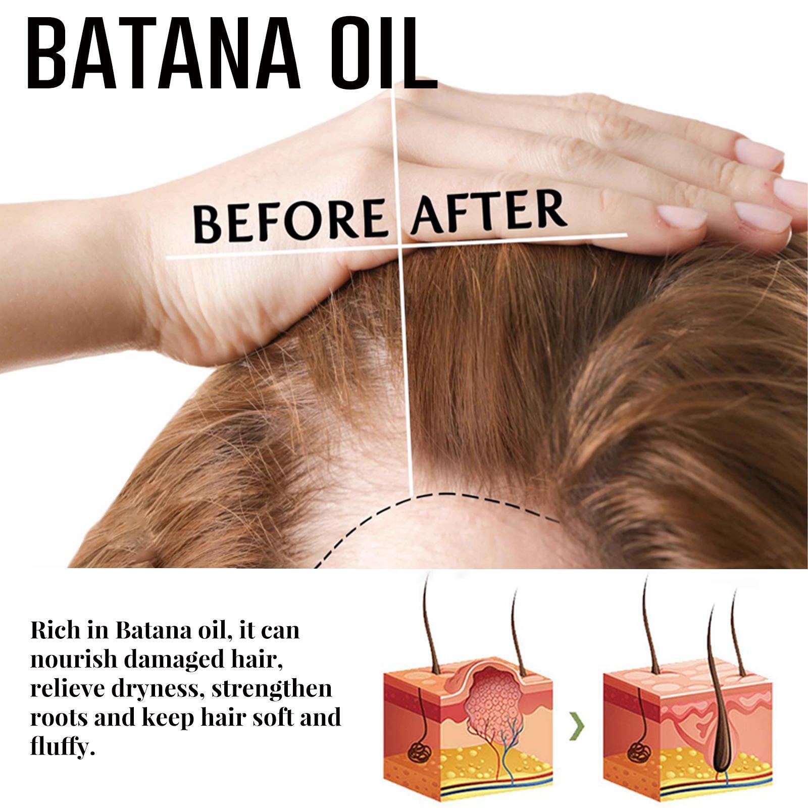Batania Hair Wax Stick With Batana Oil - Nourishing & Long-Lasting Hold, Styling For Flyaways, Adds Volume And Natural Shine, 75g Gel Haircare Batania Hair Wax Stick With Batana Oil - Nourishing & Long-Lasting Hold, Styling For Flyaways, Adds Volume And Natural Shine, 75g Gel Haircare