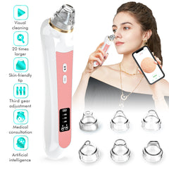 High definition visual electric blackhead absorber