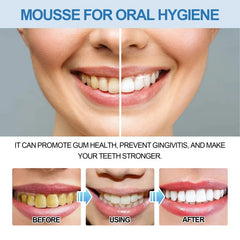 Oral Cleaning Mousse Whitening Teeth Care Gum