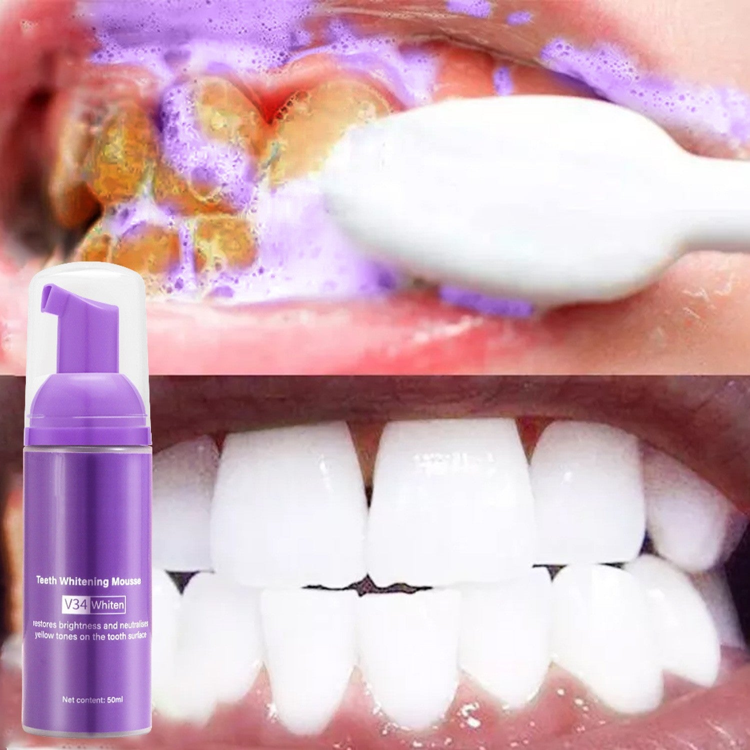 Remove Smoke Stains From Teeth Oral Care Teeth Mousse